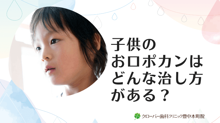 子供のお口ポカンはどんな治し方がある？