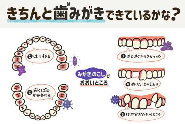 きちんと歯磨きできているかな？