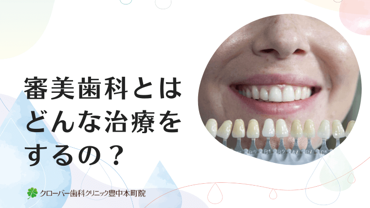 審美歯科とはどんな治療をするの？