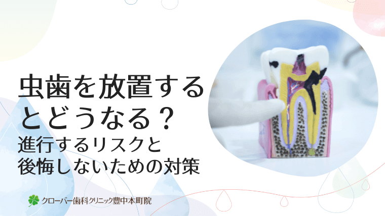 虫歯を放置するとどうなる?