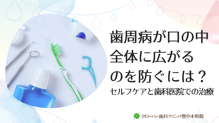 歯周病が口の中全体に広がるのを防ぐには？