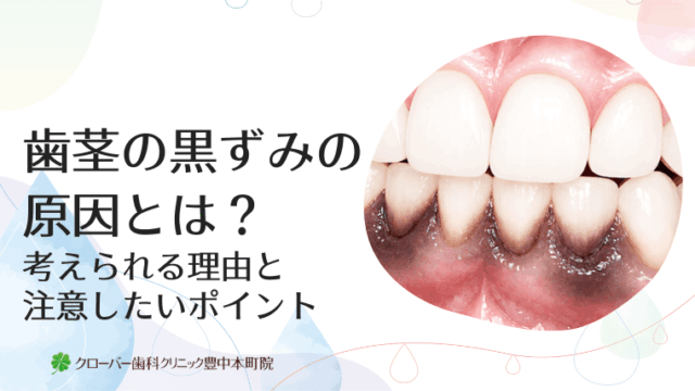 歯茎の黒ずみの原因とは？考えられる理由と注意したいポイント
