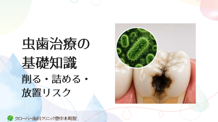 虫歯治療の基礎知識｜削る・詰める・放置リスク