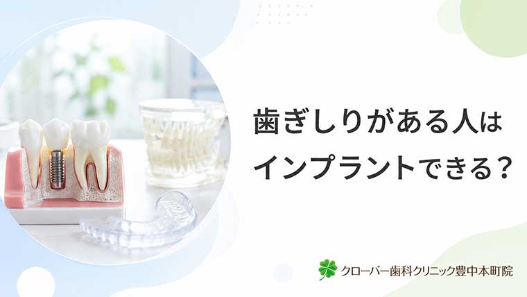 歯ぎしりがある人はインプラントできる？