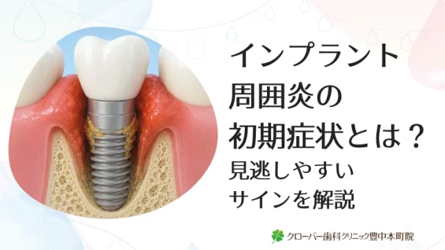 インプラント周囲炎の初期症状とは？見逃しやすいサインを解説
