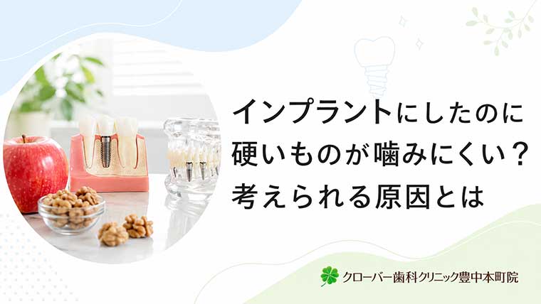 インプラントにしたのに硬いものが噛みにくい？考えられる原因とは